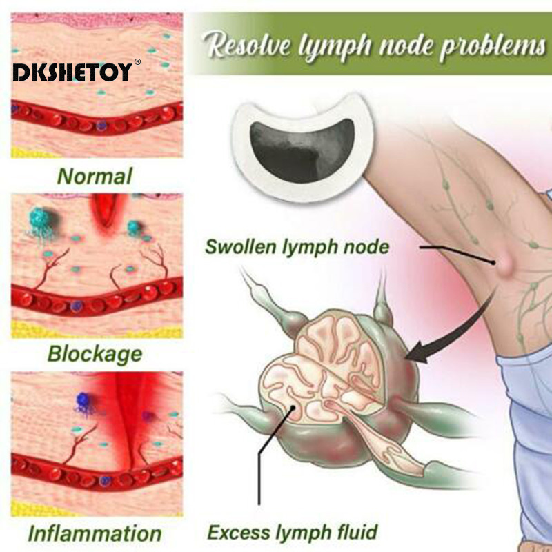 Abnehmen Patch Lymphatischen P – Herbal Weight Bewertung und Preis